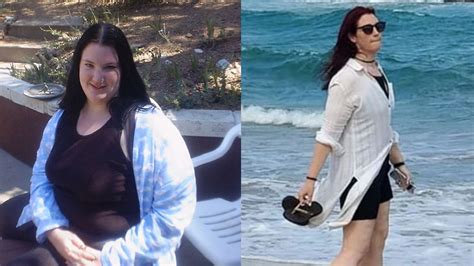 Ivy Snitzer’s Weight Loss: Know How Lap Band Surgery Left Her Starve to ...