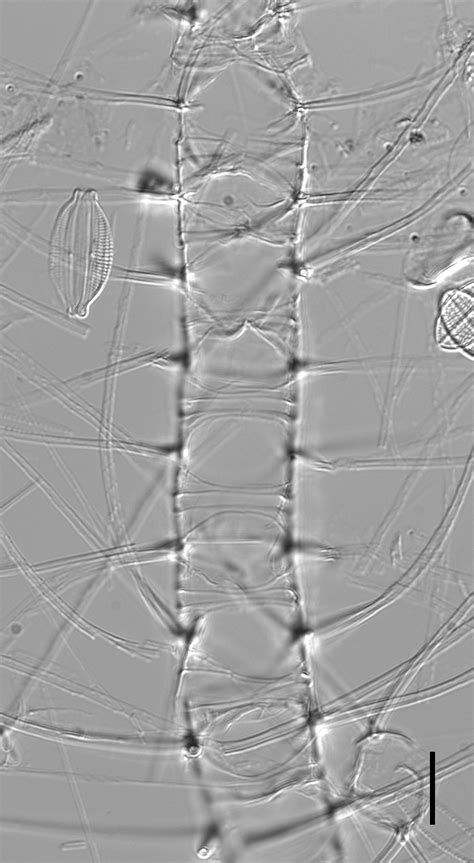 Image Chaetoceros_constrictus-LM5.jpg | Species - Diatoms of North America