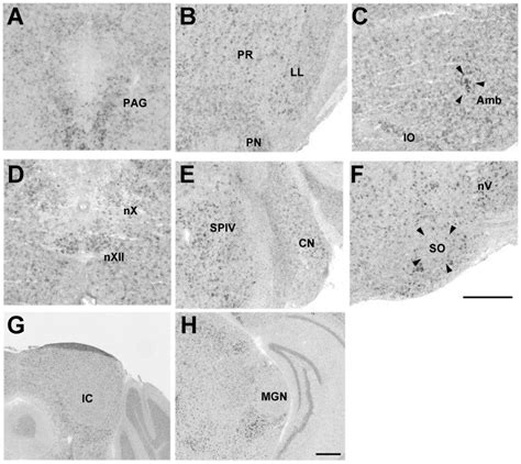 PAG (A), LL (B), Amb (C), nXII (D), CN (E), SO (F), IC (G) and medial ...