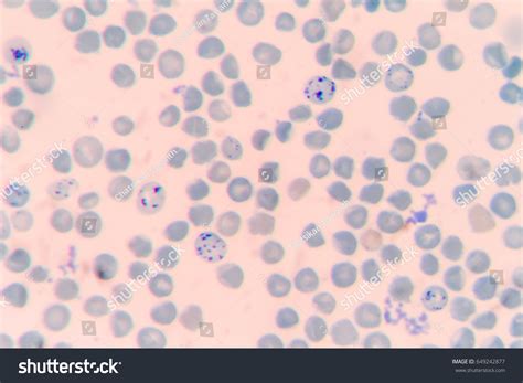 Reticulocyte New Methylene Blue Staining Stock Photo 649242877 ...