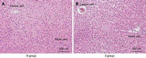 Liver Histology Kupffer Cells