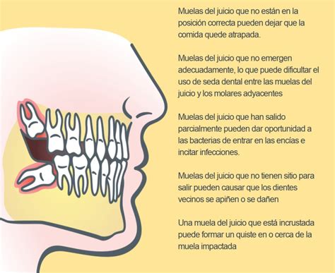 Problemas en el crecimiento de las muelas del juicio Archivos - Clínica ...