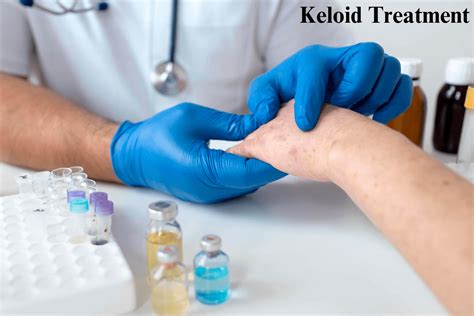 Keloid Treatment and a Reliable Solution