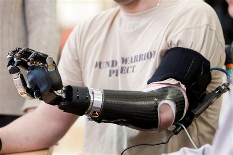 Robotic Prosthetics – Technology for the Future is Now - GizHub