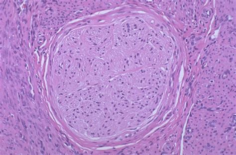 Peripheral Nerve Histology Cross Section