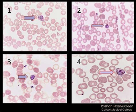 Stages In The Life Cycle Of Plasmodium