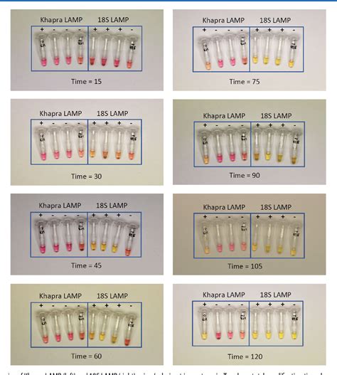 Figure 5 from A LAMP (loop‐mediated isothermal amplification) test for ...