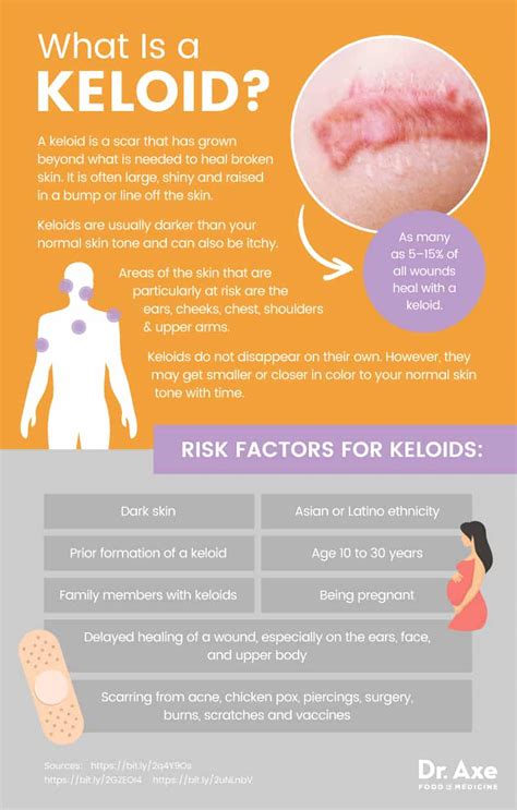 Keloid Causes (Plus, 5 Natural Tips to Help Treat Keloids) - Dr. Axe