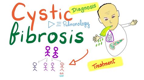 Cystic Fibrosis - Diagnosis & Treatment - Genetics - YouTube