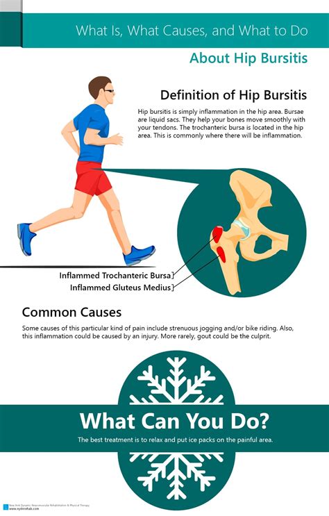 Infographic: What Is, What Causes, and What to Do About Hip Bursitis