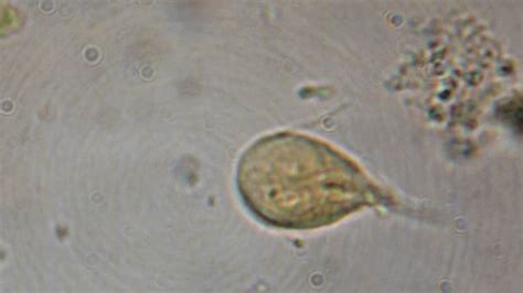 Giardia | Bruin Blog