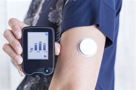 What Is a Continuous Glucose Monitoring Device – and Can It Help Me ...