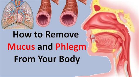 What Causes Excessive Phlegm In The Throat