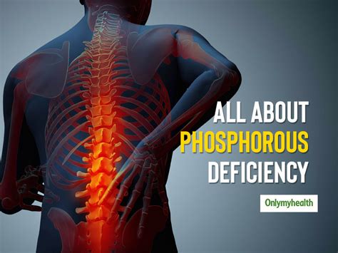 Phosphorus Deficiency: Know The Causes, Symptoms and Health Problems ...