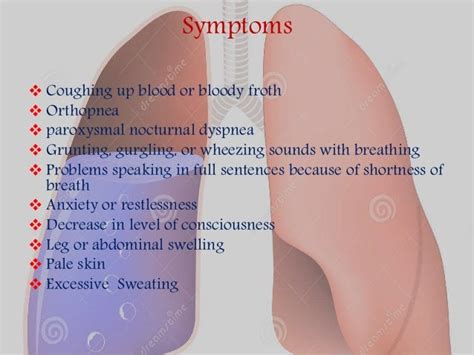 Pulmonary edema