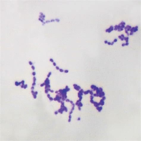 Streptococcus Microscope Slides | Carolina.com