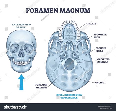 Occipital Bone Foramen Magnum