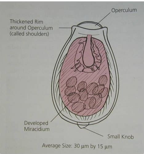 Clonorchis Sinensis Labeled