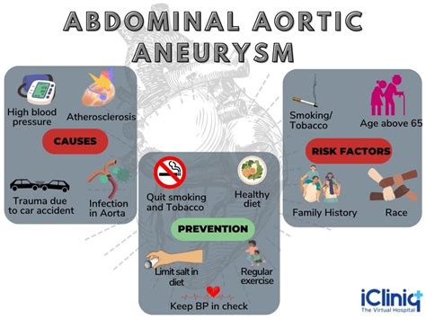 What Is Abdominal Aortic Aneurysm?