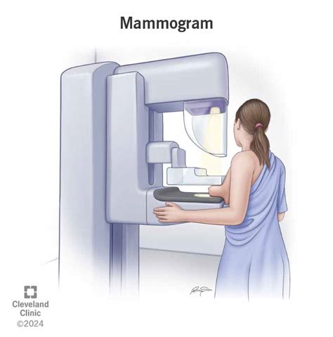 Mammogram: What It Is, Purpose, Procedure, Results & Types