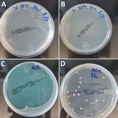 Figure 1 - Candida auris Discovery through Community Wastewater ...