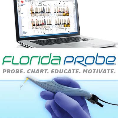 Introducing the Florida Probe to North Raleigh Periodontics