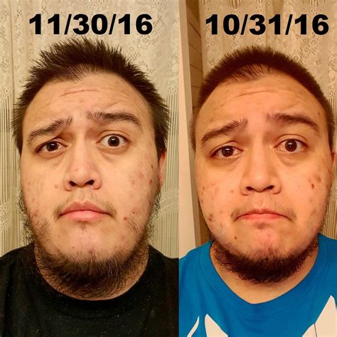 No Shave November before/after and a soap that stopped my acne :D : ftm