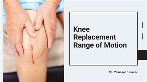 Knee Replacement Range of Motion | Knee Range of Motion Chart