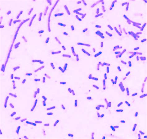 Bacillus Cereus Simple Stain