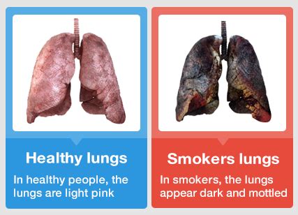 How does smoking affect your lungs? – Loving Biology