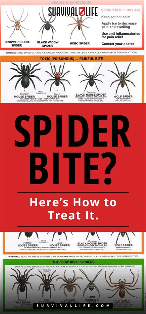 Spider Bite? Here's How To Treat It | How to Handle a Spider Bite ...