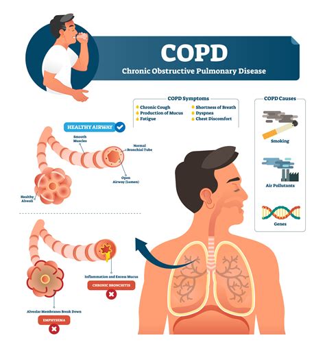 COPD Stages, Symptoms and Treatment