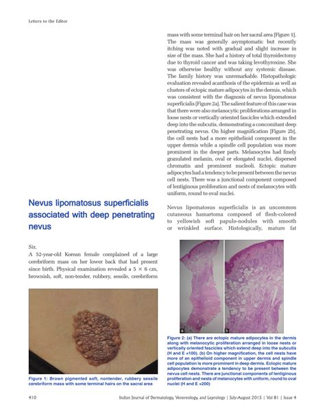 (PDF) Nevus lipomatosus superficialis associated with deep penetrating ...