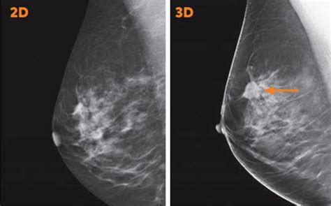 Mammography and Breast Imaging Workflows — Dicom Systems