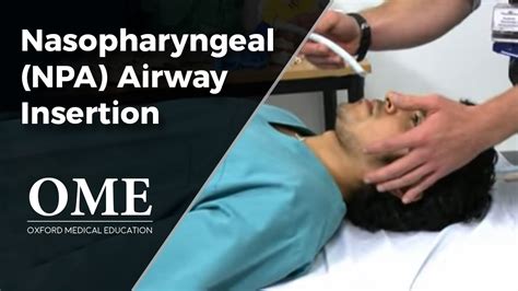 Nasopharyngeal Airway (NPA) Insertion - YouTube