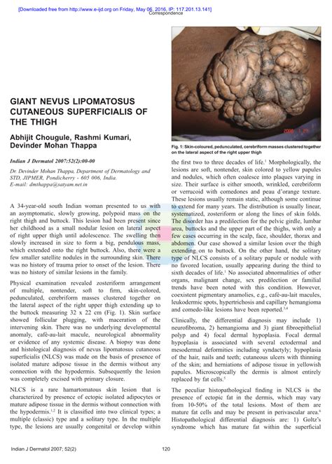 (PDF) Giant nevus lipomatosus cutaneous superficialis of the thigh