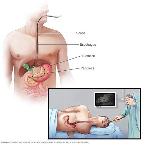 Stomach Cancer Symptoms & Diagnosis – Intelligent Haptronic Solutions Inc.