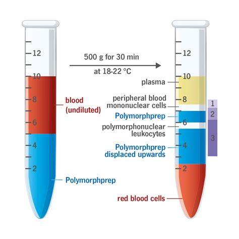 Density Gradient Media