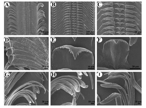 Phylum: Mollusca & their radula | Cephalopod Radula under the SEM