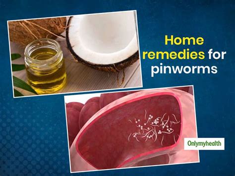 Use These 5 Natural Home Remedies To Get Rid Of Pinworms | OnlyMyHealth