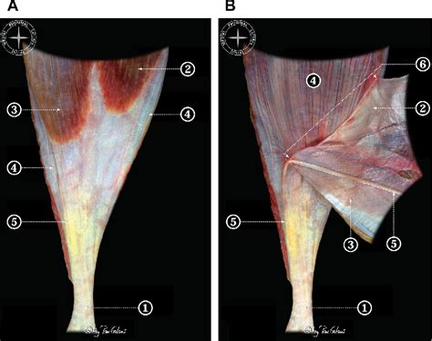 Figure 15 from Anatomy of the triceps surae: a pictorial essay ...