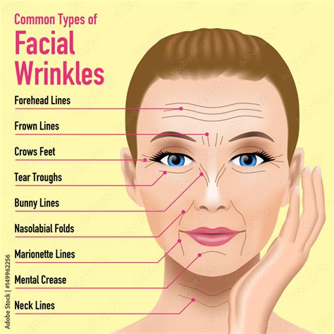 Common Types of Facial Wrinkles. cosmetic surgery. woman facial ...