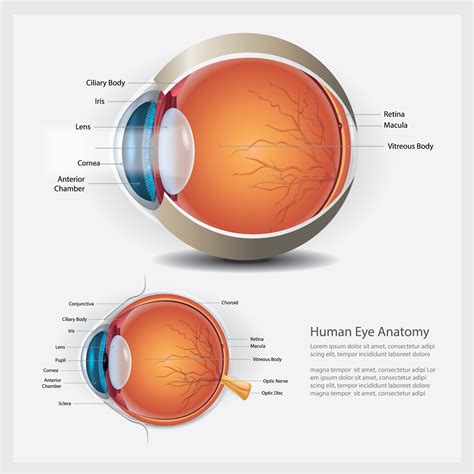 Macular Pucker - What Is It and How Does It Affect One's Vision