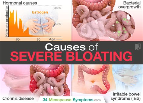 Severe Bloating: Important Things to Know | Menopause Now