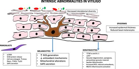 Vitiligo Types - VitiligoHub