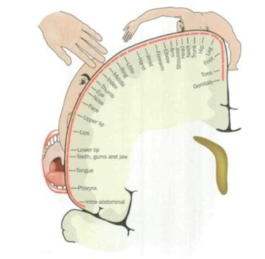 Phantom Limb Pain - Physiopedia