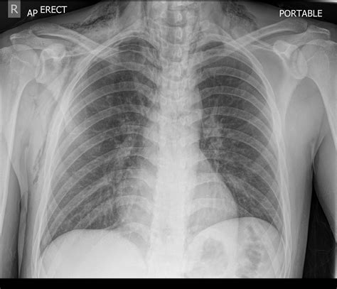 the xray doctor: xrayoftheweek 48: where is the gas?