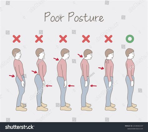 Poor Good Posture Back Posture Problems Stock Illustration 2134161337 ...