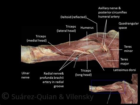 The Radial Nerve - Course - Motor - Sensory - TeachMeAnatomy