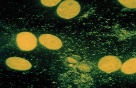 Mycoplasma Contamination | ATCC